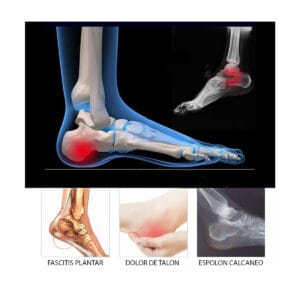 Talonera Gel Alto Impacto Espolón Fascitis Plantar Talonera De Descanso - vista 3