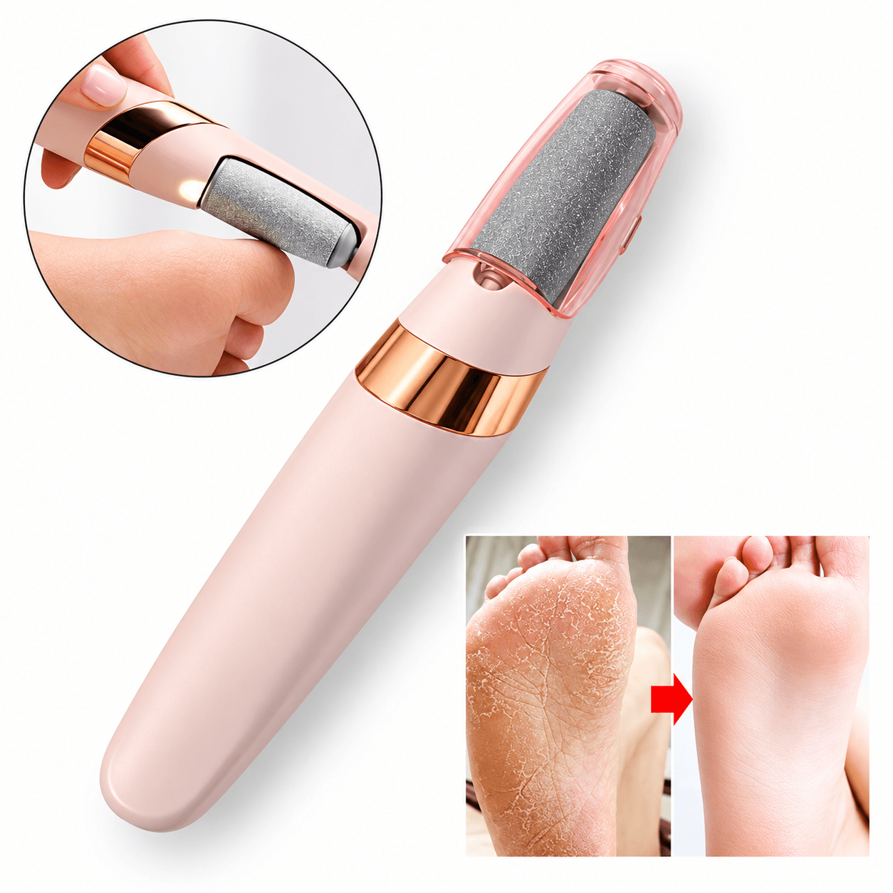 Exfoliador Removedor de Callos Eléctrico LT-25M21 - Imagen 2